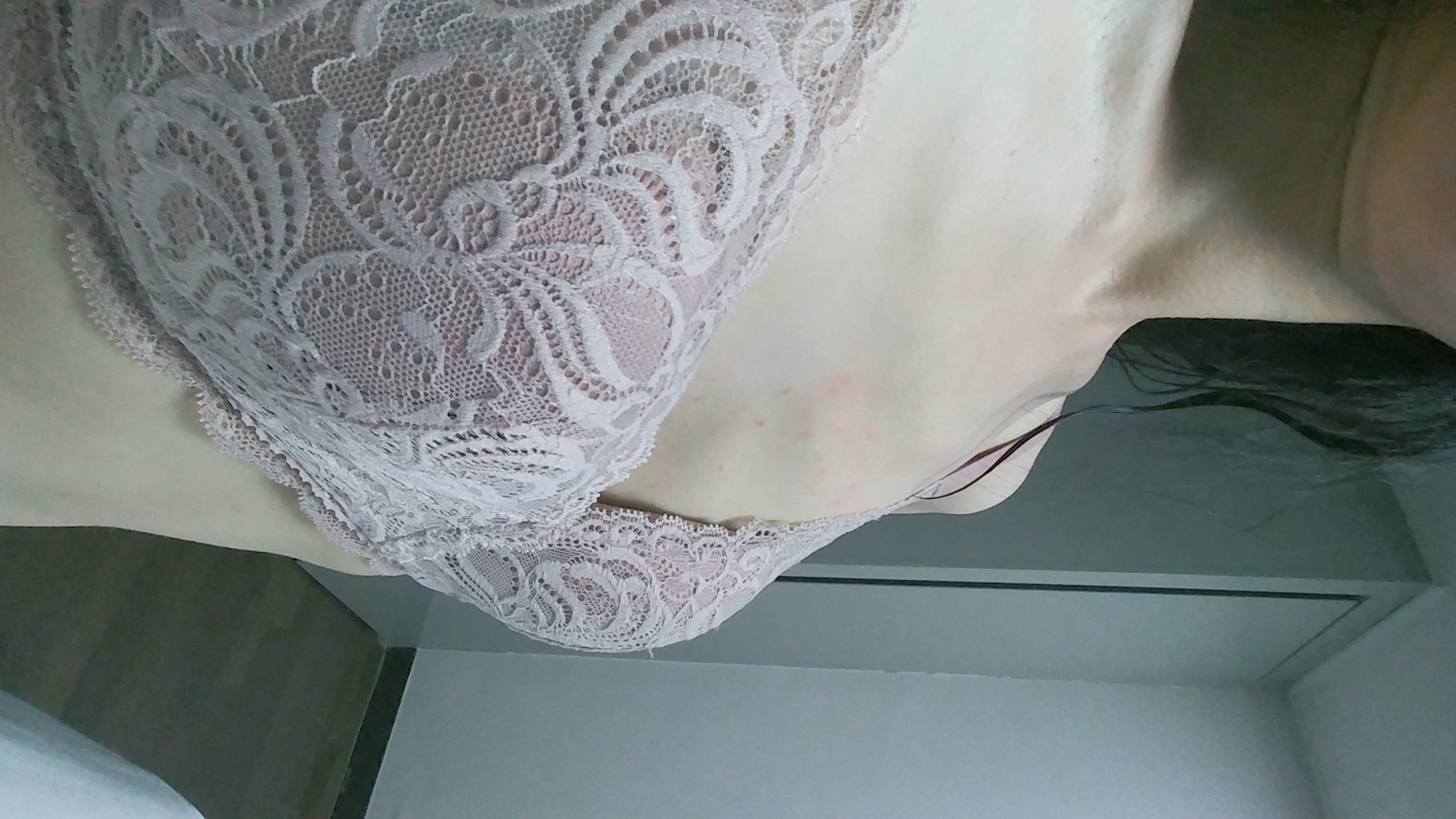 수술전 후기 올려요