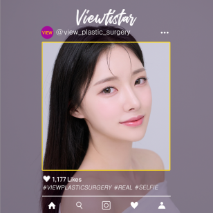 [3 Types Face Countouring, Rhinoplasty] Hong Jua