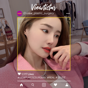 [Rhinoplasty] Lee Yuri