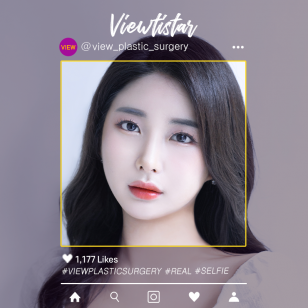 [3 Types Face Contouring, Lateral Canthoplasty, Lateral Hotz Canthoplasty] Cha Seohyun