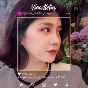 [Rhinoplasty, Fat graft surgery] Lee Minju