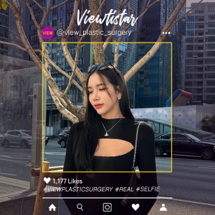 [Rhinoplasty revision] Pimanara
