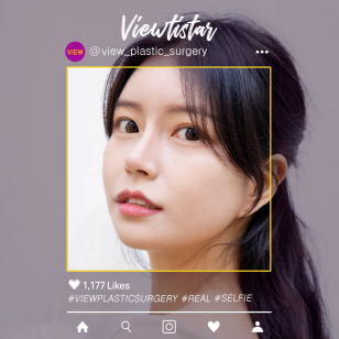 [3 Types Face Countouring + Rhinoplasty] Kim Hyunjin