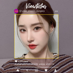 [3 Types Face Countouring + incisional double eyelid surgery + Rhinoplasty + Pyriform Augmentation] Lee Yuri