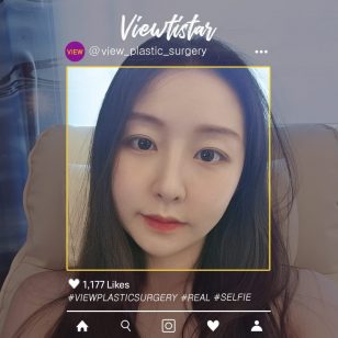 [Facial Contouring + Rhinoplasty + Eye] Lee Yujin