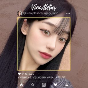 [Operasi Hidung] Kang Sehee | Plastic Surgery Korea
