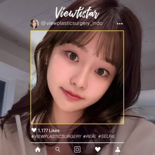 [Kontur Wajah 3 Jenis + Operasi Hidung] Park Seohyun | Plastic Surgery Korea