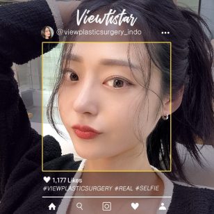 [Operasi Hidung + Reposisi Lemak Bawah Mata] Lee hyeri | Plastic Surgery Korea