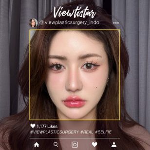 [Operasi Revisi Mata+Operasi revisi hidung] Ploywarat Nithidechathorn | Plastic Surgery Korea