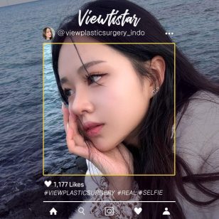 [Operasi Hidung] Lim Sohyeon | Plastic Surgery Korea
