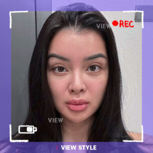 Plastic Surgery in Korea: My Experience at VIEW Plastic Surgery