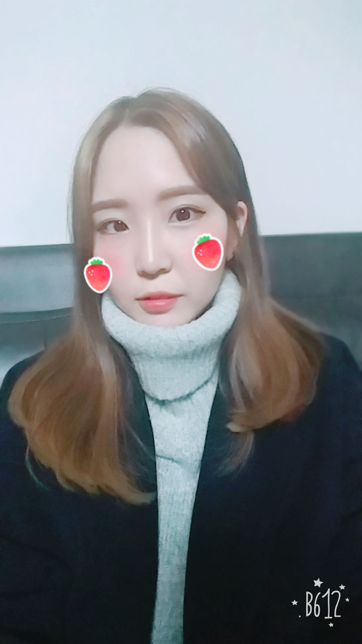 Rhinoplasty성형 5개월차 후기에요~~