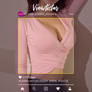 [Breast Augmentation(Motiva)] Kim Rin a