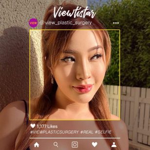 [Revisional Rhinoplasty] Jattuporn Tassananutriyakul