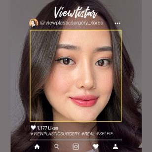 [Контурная пластика в 3точках, Блефаропластика, Ринопластика] Priscilla Setio | Plastic Surgery Korea