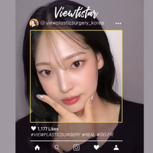 [Ринопластика] Seo Jinyoung | Plastic Surgery Korea
