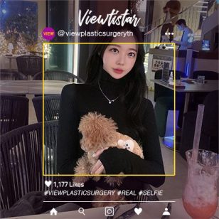 [โครงหน้า 3 จุด+แก้ไขจมูก+แก้ชั้นตาสองชั้น] Kim Seyeon