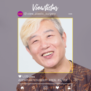 [ศัลยกรรมยกคิ้ว + กรีดเย็บเก็บผิวส่วนเกินตาล่าง] Han Dongin