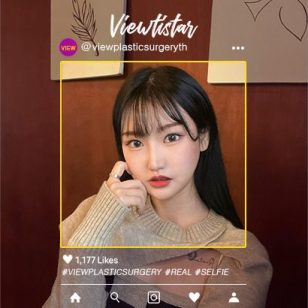 [โครงหน้า 3 จุด + เสริมจมูก + ทำตาสองชั้น] Kim Sujeong
