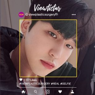 [Lee Sanghun] โครงหน้า 3 จุด + ทำตาสองชั้น + เสริมจมูก
