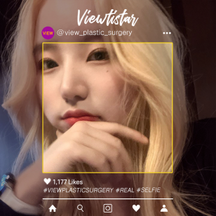 [เสริมจมูก]Kim Heejin