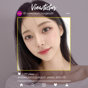 [โครงหน้า 3 จุด + เสริมจมูก] Hong Jua | Plastic Surgery Korea