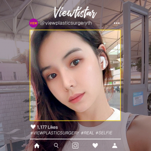 [ฉีดไขมันหน้า+ร้อยไหม] Lee Sohee | Plastic Surgery Korea