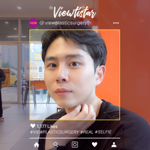 [ทำตาสองชั้น+ปรับกล้ามเนื้อตา] Kim Doyoung | Plastic Surgery Korea