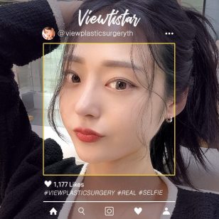 [เสริมจมูก + จัดเรียงไขมันใต้ตา] Lee hyeri | Plastic Surgery Korea