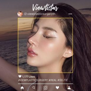 [แก้จมูก+ทำตาสองชั้น+ตัดปีกจมูก] Sasi Ngiunwan | Plastic Surgery Korea