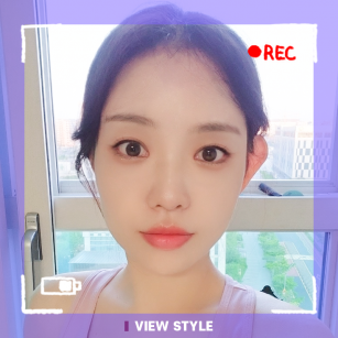 [ศัลยกรรมตา / จัดเรียงไขมันใต้ตา / ร้อยไหม / ฉีดไขมันหน้า] กลับไปสวยเหมือนตอนช่วงอายุ 20?