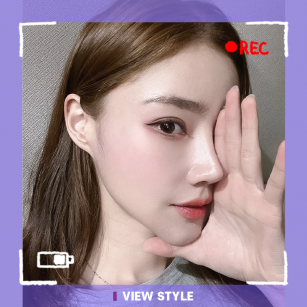 [ศัลยกรรมจมูกเกาหลี] ละลายฟิลเลอร์เก่าพร้อมกับทำจมูกใหม่ด้วยทรงที่สวยปัง สโลปปลายพุ่ง✨
