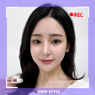 [ศัลยกรรมแก้จมูก/ศัลยกรรมโครงหน้า/ฉีดไขมันหน้า] โรงพยาบาลวิวทำถึงจริง สวยขึ้นจนจำไม่ได้