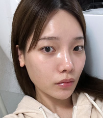 facial contour sec03 bottom after1 pc