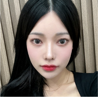 facial contour sec03 bottom after2 mo