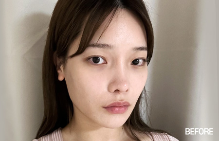 facial contour sec03 bottom before1 pc