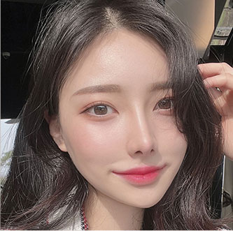 facial contour sec03 top after1 mo