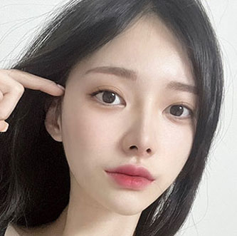 facial contour sec03 top after4 mo