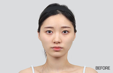 facial contour sec03 top before pc