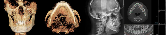 facial contour slide 03 sub pc