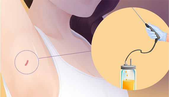 correction sec3 tap01 01