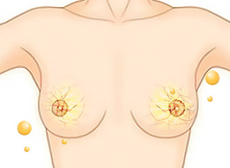 correction sec3 tap02 02