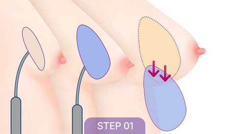 correction sec3 tap03 01 1