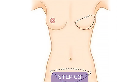 correction sec3 tap03 06