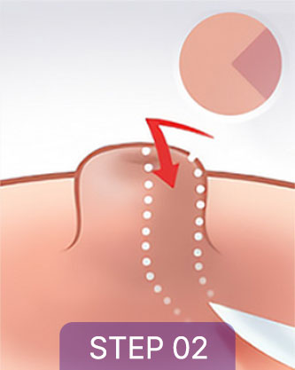 correction sec3 tap04 02 mo