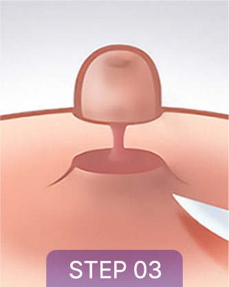 correction sec3 tap04 03 mo