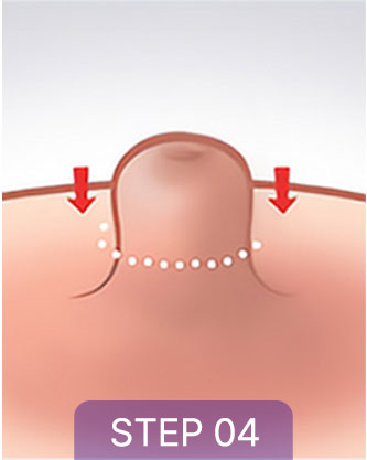 correction sec3 tap04 04 mo