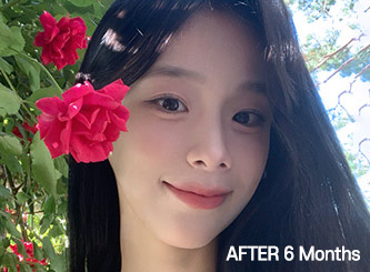 jaw main ba bottom after mo