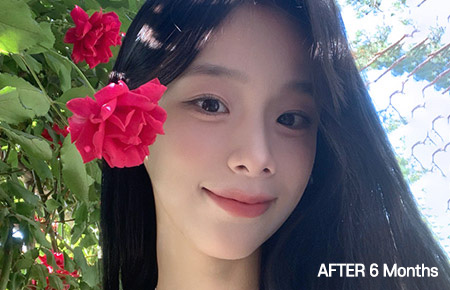 jaw main ba bottom after pc