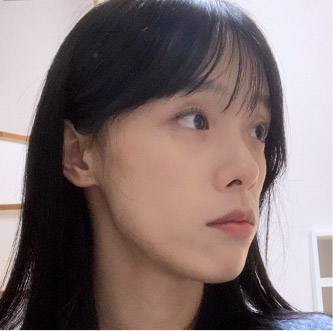 jaw main ba bottom before0m mo